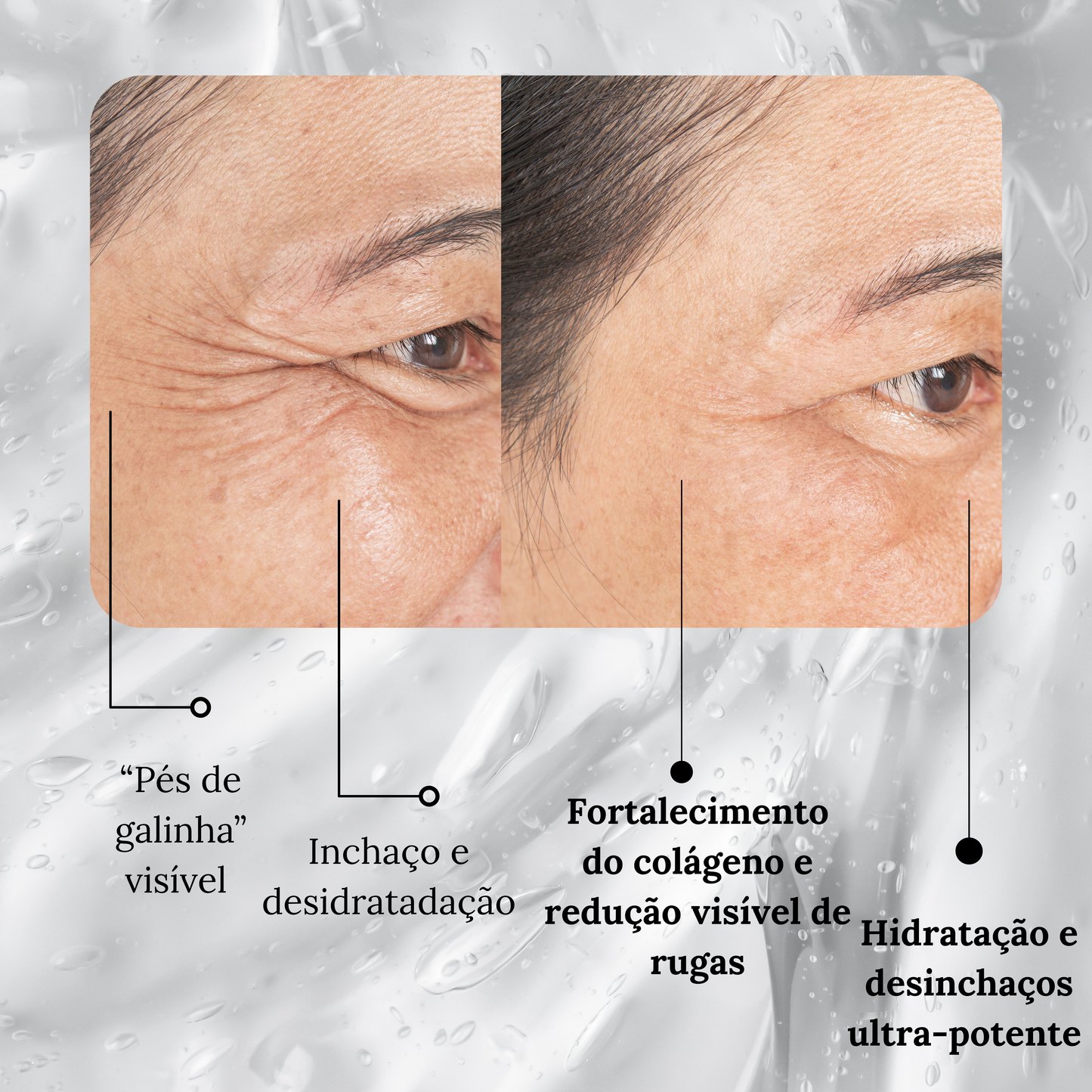 CREME PARA OLHOS COM PEPTÍDEOS E COLÁGENO – ANTIRRUGAS E ANTIOlHEIRAS